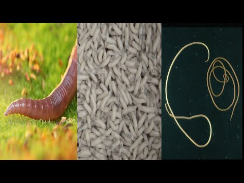 Video: ¿Cuál de los siguientes es un gusano redondo?