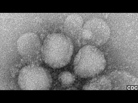 First Case Of Dangerous MERS Virus Reported In U.S.