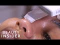 I got my blackheads professionally extracted for 235  beauty explorers  beauty insider