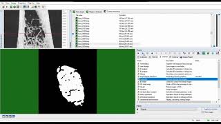 Automated segmentation of trabecular and cortical bone - CTAn - MicroCT