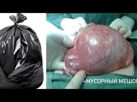 Video: Kaj je urogenitalna odprtina fetalnega prašiča?