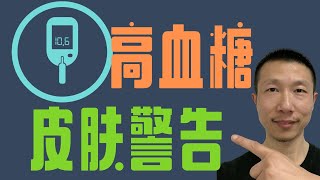 胰岛素抵抗，高血糖，糖尿病出现在你皮肤上的12个警告信号