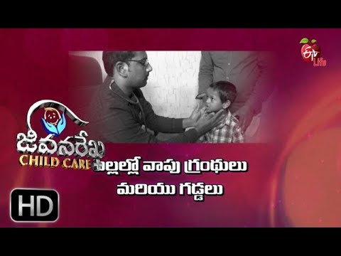 Jeevanarekha child care  Swollen Glands and Lumps in Children  16th Aug 2018    