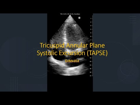 Validation of the Tricuspid Annular Plane Systolic Excursion