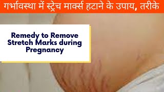 STRETCH MARKS During Pregnancy | गर्भावस्था में स्ट्रेच मार्क्स हटाने के उपाय, तरीके #stretchmarks