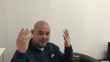 Sam’s Story Of Scalp Micro Pigmentation at Creative Scalps - Hair Tattoo helped ‘cure’ Baldness