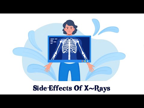 Side Effects of X Ray Radiaton