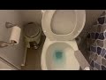 Simple Life Pumice Stone Toilet Bowl Cleaner   Toilet Pumice Stone with Extra Long Handle