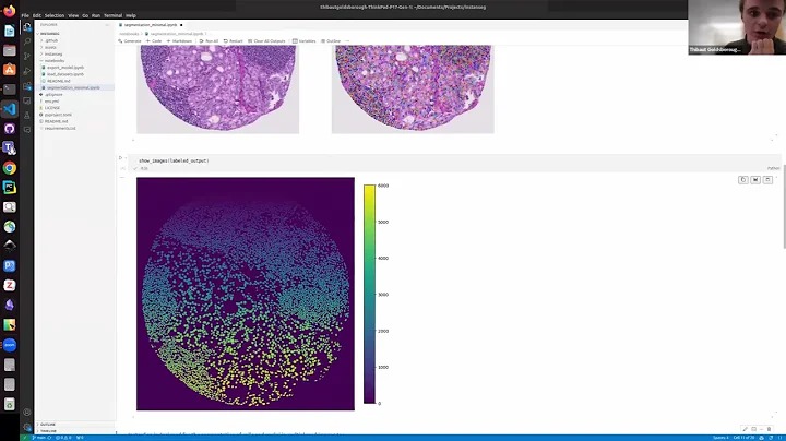 Introducing InstanSeg, a deep learning-based method for the segmentation of cells in brightfield