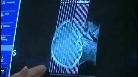 CT scan - Imaging in medicine (3/13)