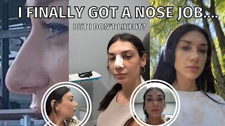 I GOT A NOSE JOB. (MY RECOVERY & RESULTS VLOG) HERE'S THE TEA 🙂☕️