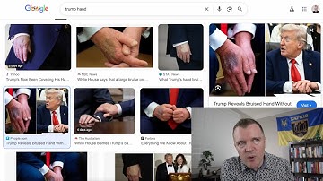 Everyone is Just Waiting for Trump to Pass Away