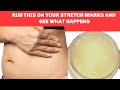 Look What I Use To Fade Stretch Marks | I Should Have Shared This Sooner