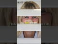 Explore the Different Types of Blinds | Lorraine’s Window Coverings