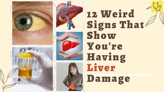 Unlocking the Secrets of the Liver: 12 Surprising Signs of Damage You Need to Know!