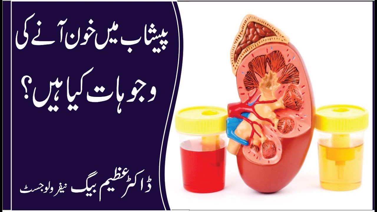 what can cause blood in urine