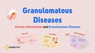 Chronic Inflammation and Granulomatous Diseases | Granulomatous Diseases | Immunology