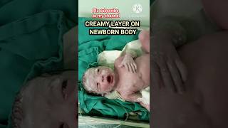 Vernix caseosa is the creamy layer on newborn#creamy#newborn#shortfeed#viral#trending