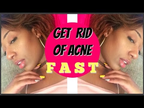 How To Get Rid Of Acne Scars Ft. MDComplete Acne Clearing System