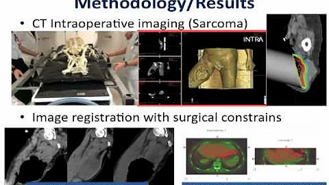 Image Guided Surgery in real clinical scenarios - Javier Pascau