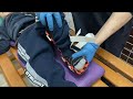 الطريقة الصحيحة لتلبيس جبيرة القدم لحالات التأخر الحركي والشلل الدماغي AFO GUIDE الطريقة الصحيحة لتلبيس جبيرة القدم لحالات التأخر الحركي والشلل الدماغي AFO GUIDE