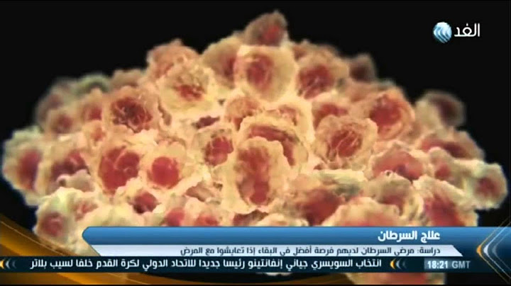 التعايش مع مرض السرطان أفضل من العلاج