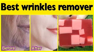Best Home Remedies for Anti aging and Glowing Skin | Fine Lines AND Wrinkles Removal Home Remedy