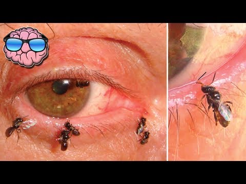 Top 10 Crazy Things Found Living Inside People