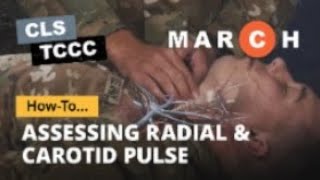 Tccc Assessing Radial And Carotid Pulse How To For Combat Life Savers