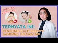 Panduan Ampuh Hilangkan Jerawat pada Kulit Sensitif & Berminyak