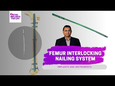 Femur Interlocking Nailing System | Implant & Instruments