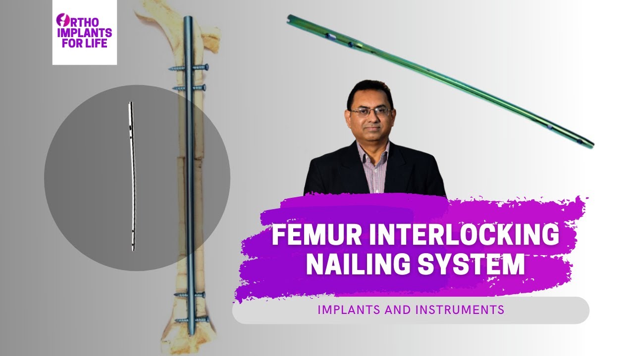 Femur Interlocking Nailing System | Implant & Instruments