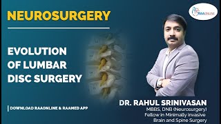 Neurosurgery | Evolution of Lumbar Disc Surgery | Raaonline #lumber #discsurgery