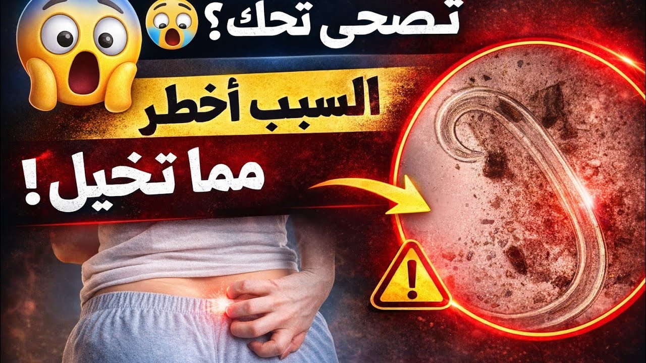 Enterobius Vermicularis الديدان الدبوسية كما لم تراها من قبل + السلوفان تكنيك + الاعراض والتشخيص