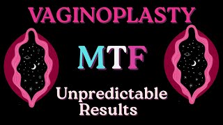 🌸 Deep Feminization + Vaginoplasty Energetics | MTF Subliminal Hypnosis for Inner Alignment