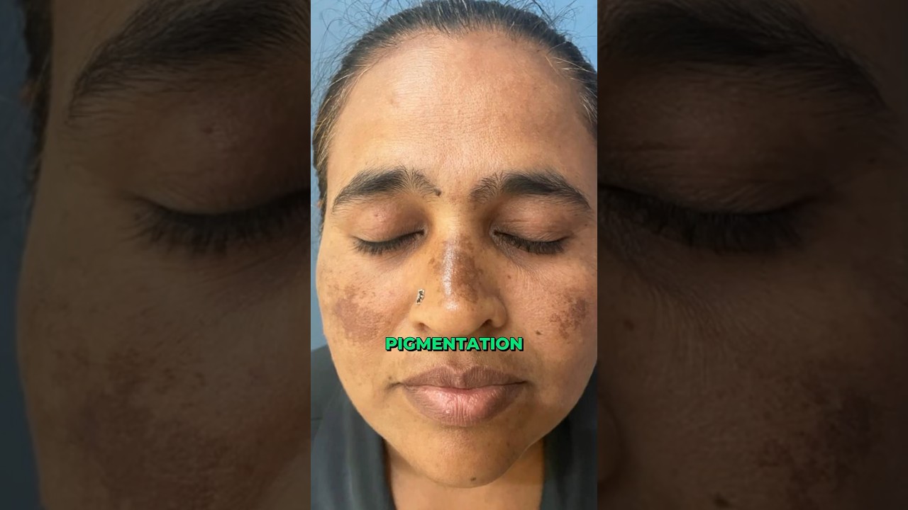 Sunscreen for glowing skin, no white cast, prevents dark spots and pigmentation 