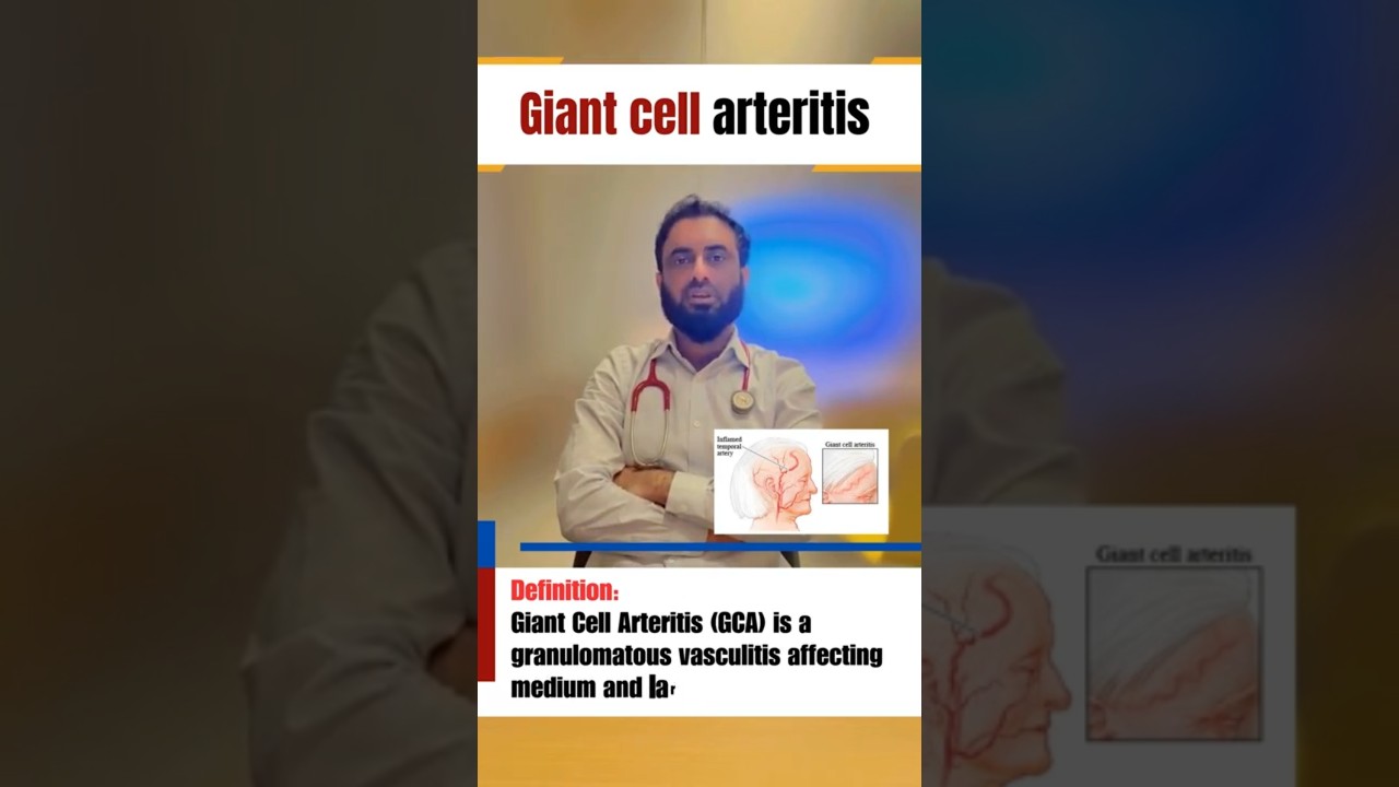 Giant Cell Arteritis | Exam Key Points | Dr Hafiz Atif | AMC, NRE, FCPS, & UAE Exams