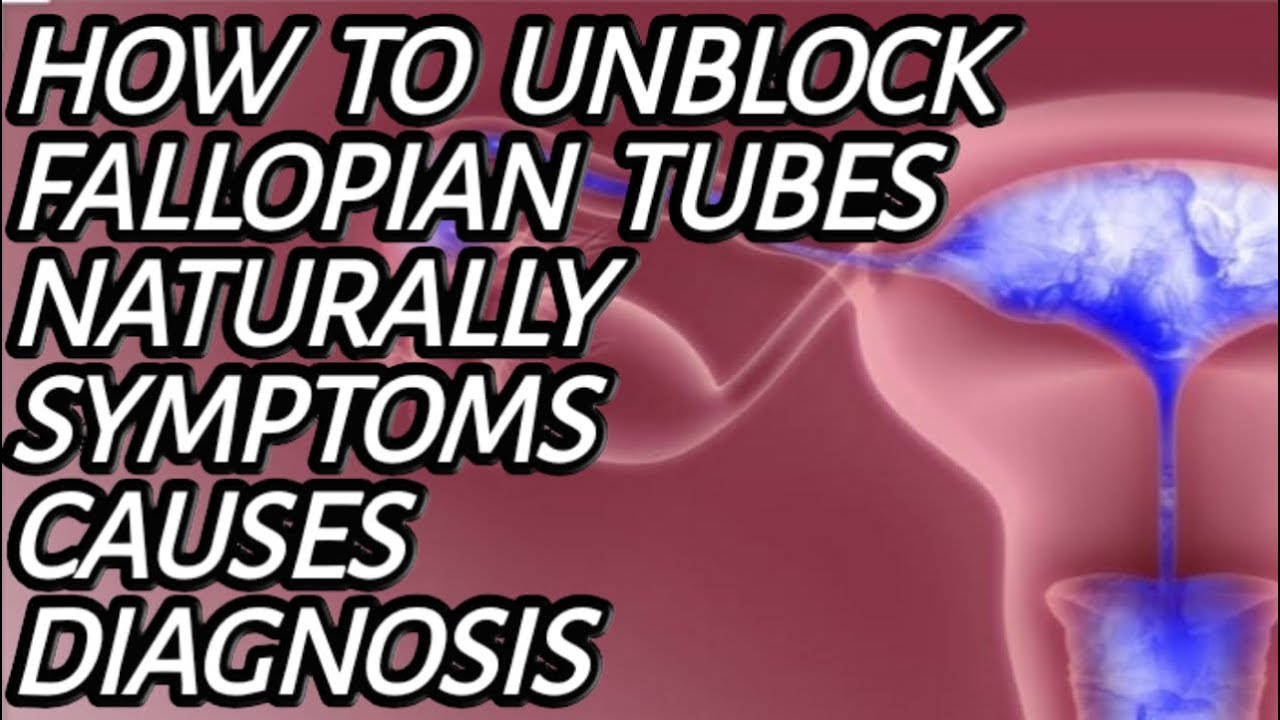 Fallopian tube blockage symptoms _ Causes_Diagnoses How to Unblock