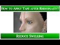 1st Appointment after Rhinoplasty- 6 Taping your nose to reduce swelling: Speed up healing