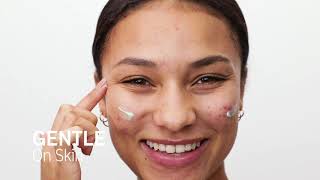 New Fast Acting Blemish Treatment