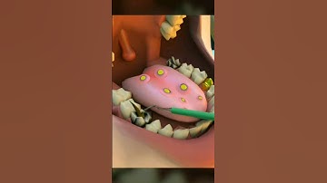 Dental problem #asmr #asmrvideo #asmrsounds #animation #dental #dentist #doctor #shorts #tretment