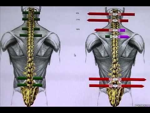 NUCCA Technique- chiropractic