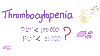 Thrombocytopenia | Why Is My Platelet Count Low?