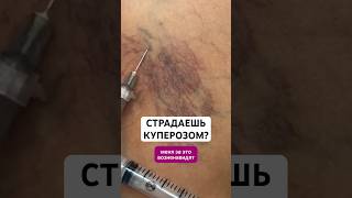 Нашла классное средство от купероза, арт. 430726835