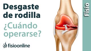 Efectos prehabilitación postoperatoria en pacientes artroplastia total  rodilla - Ecufis - Cursos presenciales y online para Fisioterapeutas