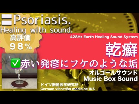 🔴Psoriasis. Healing music with Dr. Rife.｜Music Box Sound【528Hz】【ASMR】