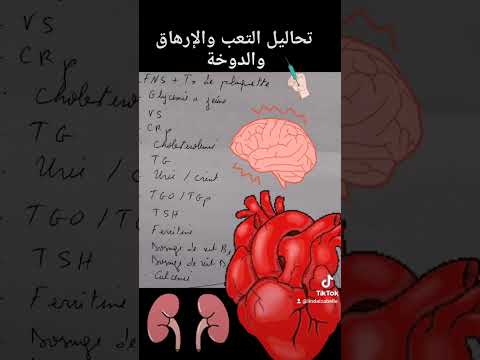 تحاليل التعب والارهاق والدوخة