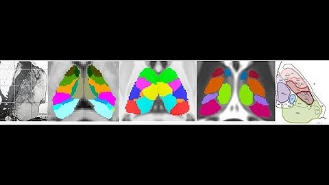 Thalamic Segmentation e-Symposium - Welcome Note