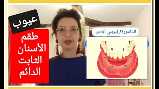 عيوب و مشاكل طقم الأسنان الثابت الدائم و الحلول Permanent fixed denture Prothèse dentaire