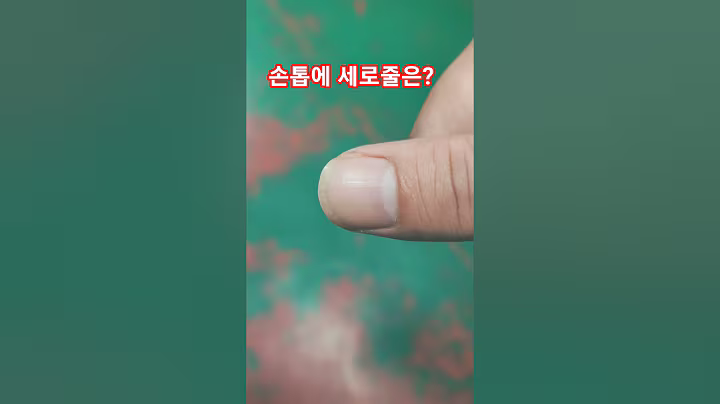 손톱의 세로줄은 무엇 때문 일까요? #건강정보